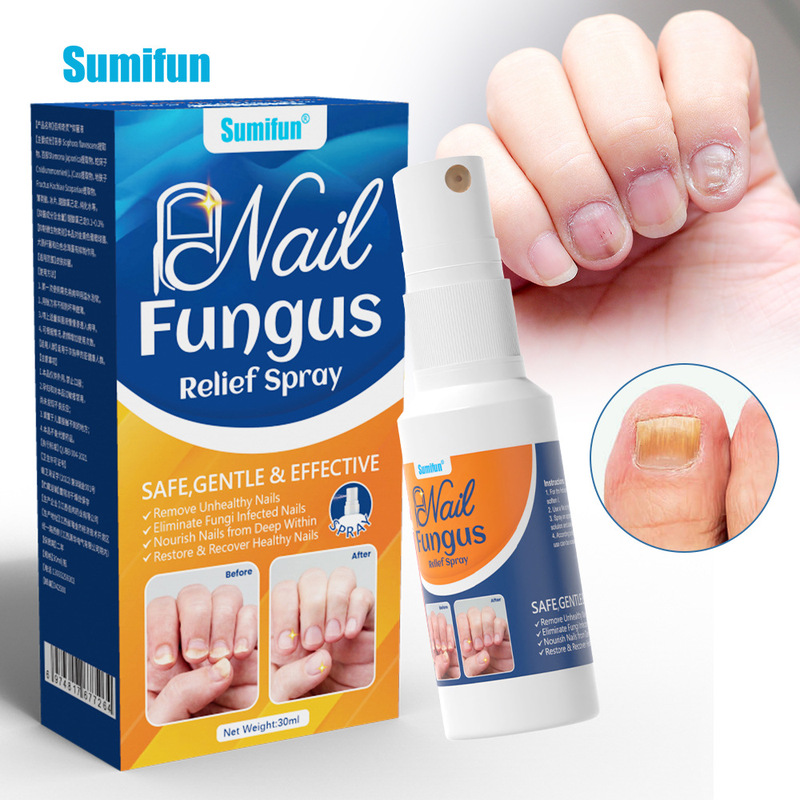 Sumifun Nail Fungus Care Spray Cross-Border Trade Nail Fungus Care Solution External Use Nail Spray K50010