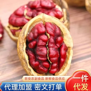 ����خa�tƤ��Ƥ�t�º��ұ�Ƥ������ԭζ��ͯ��ʳ��ʳ���lɽ����