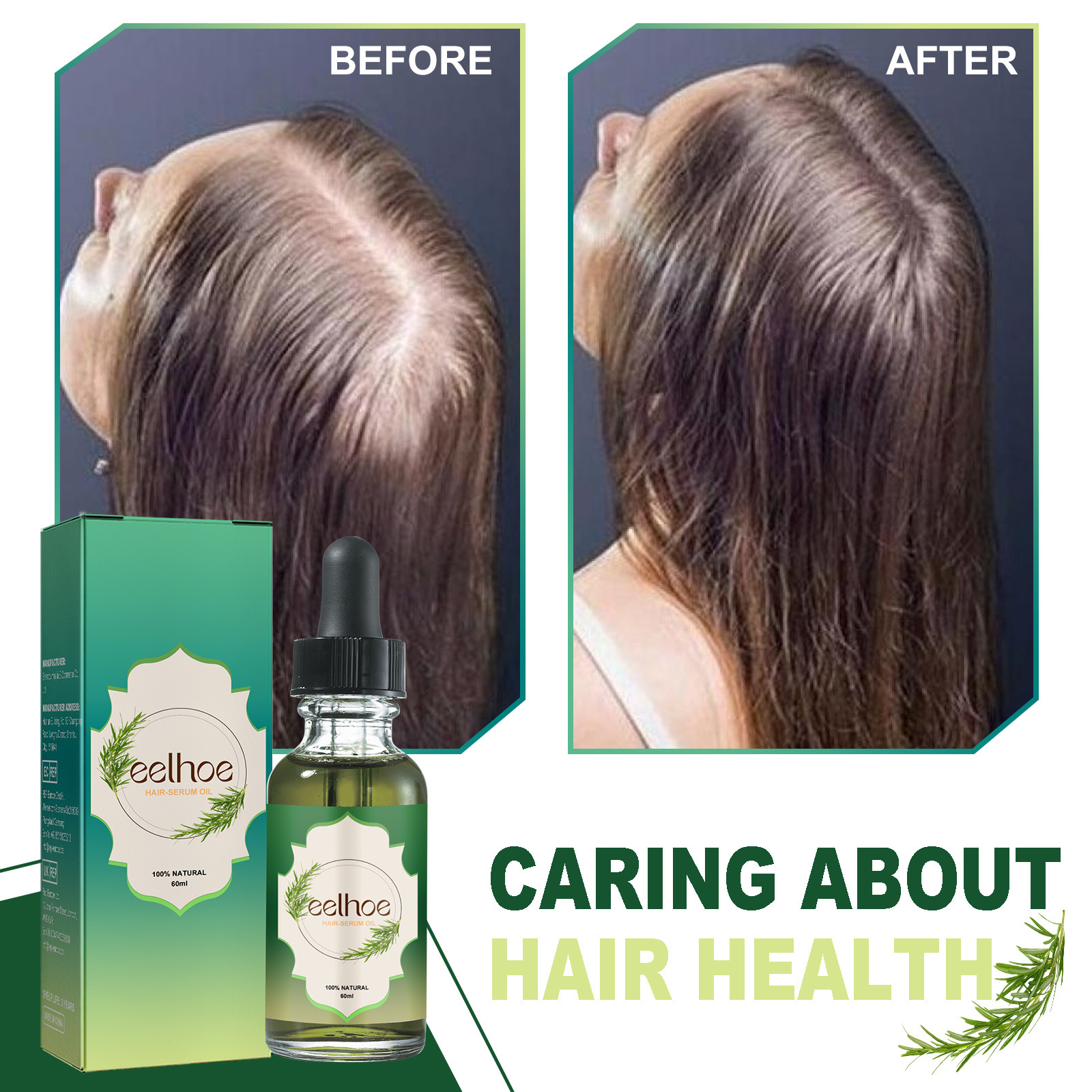Haar-Rosmarin-Essenzöl pflegt die Kopfhaut und beugt Haarausfall vor. Es ist ein dickflüssiges, feuchtigkeitsspendendes, starkes und feuchtigkeitsspendendes Mittel_voghion.com
