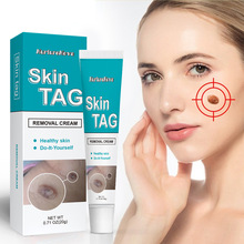 羳skin tag removal cream u۸ƽ Ƥwo