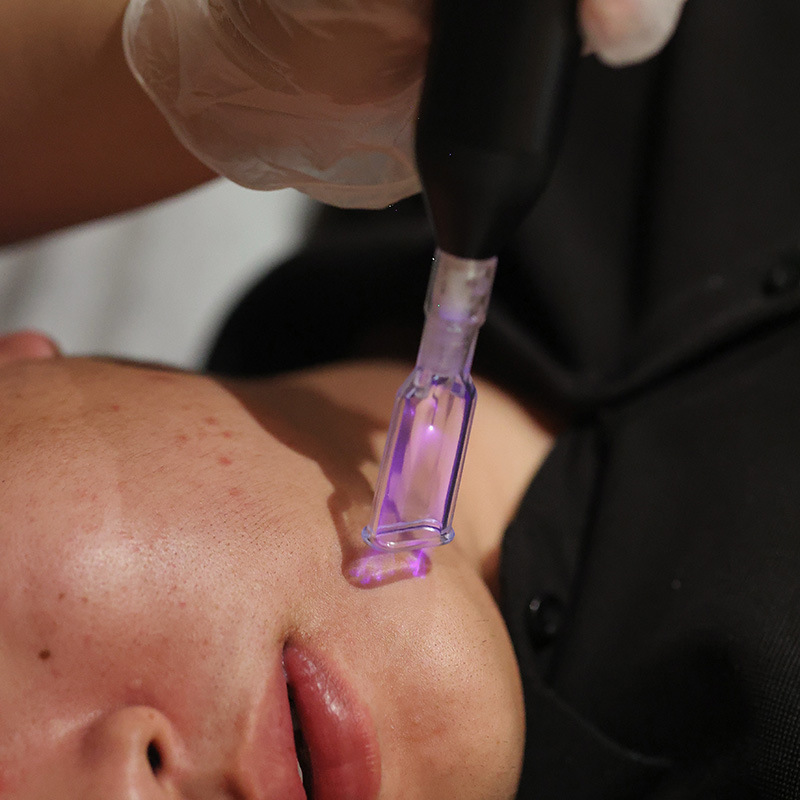 DR plasma frío multifunción de manejo de la piel instrumento integral salón de belleza instrumento de reparación antienvejecimiento equipo de belleza máquina integrada