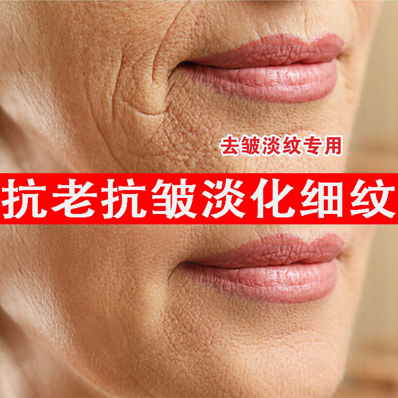 レチノール抗シワ精華液はシワを引き締めて細目を明るくします。|undefined