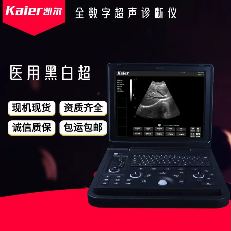彩超b超机价格医院便携式b超机报价医疗笔记本b超超声设备二维