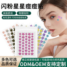 ��ɫ�W��������NPE ˮ�z�w��ē�ڶ��N�ճ��o�w���x��覶����N