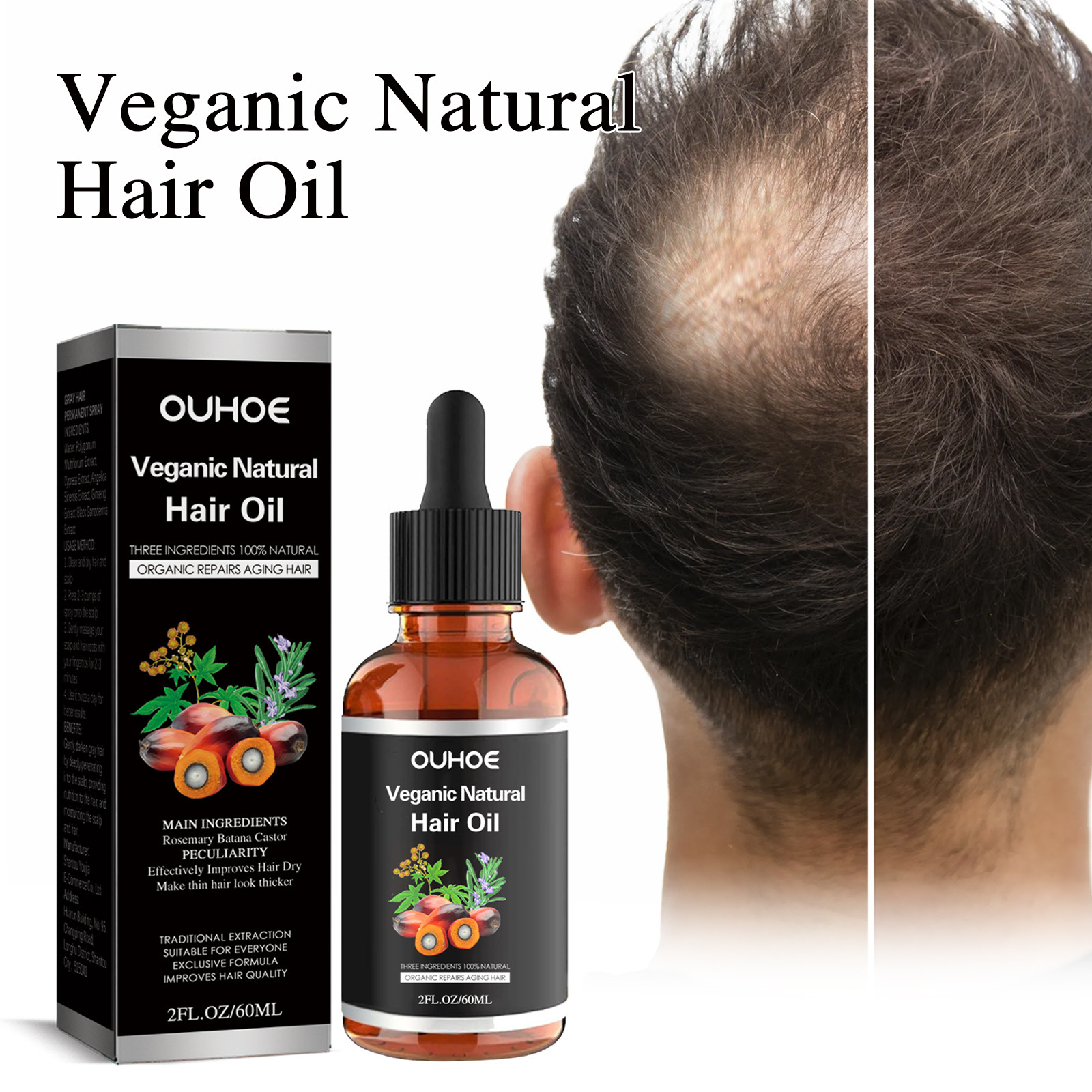 Hidratante OUHOE Misturado e Curativo Anti-queda Forte Firmador Denso Óleo Essencial para Cuidados com os Cabelos_voghion.com