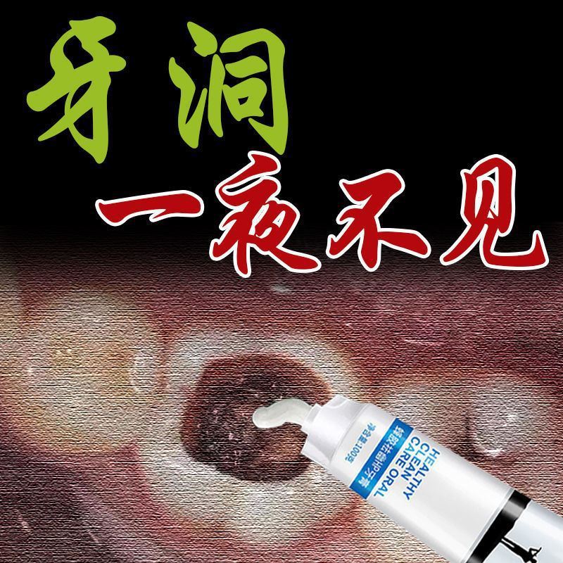 [line up purchase Fill a tooth Decayed tooth repair Fillers Artifact Sealant