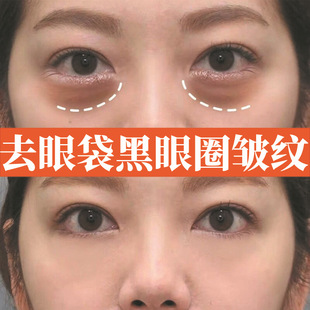 ���ر��������z��˪ȥ���o�µ����۴�����Ȧ����˪���Ŀ�����˪