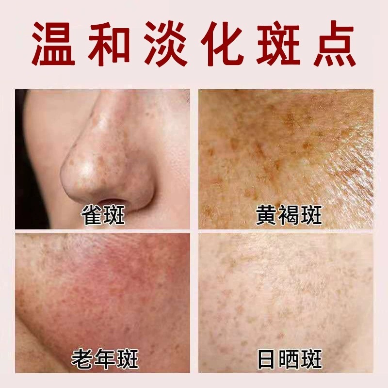 色素分解液、美白液、シミ除去液、シミ、そばかす、色素分解、ナイアシンアミド、ブラックエッセンス、美容室|undefined