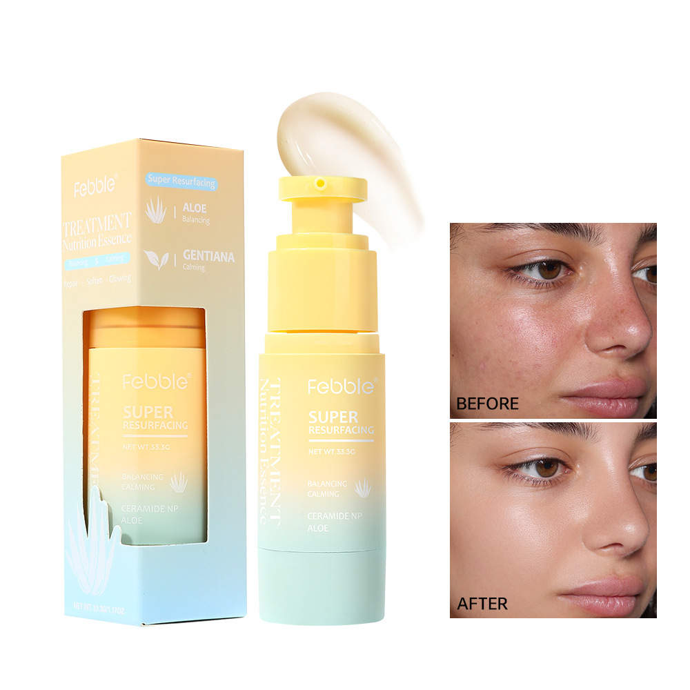 Febble spot transfronterizo venta caliente espuma limpiador facial de mousse limpieza profunda