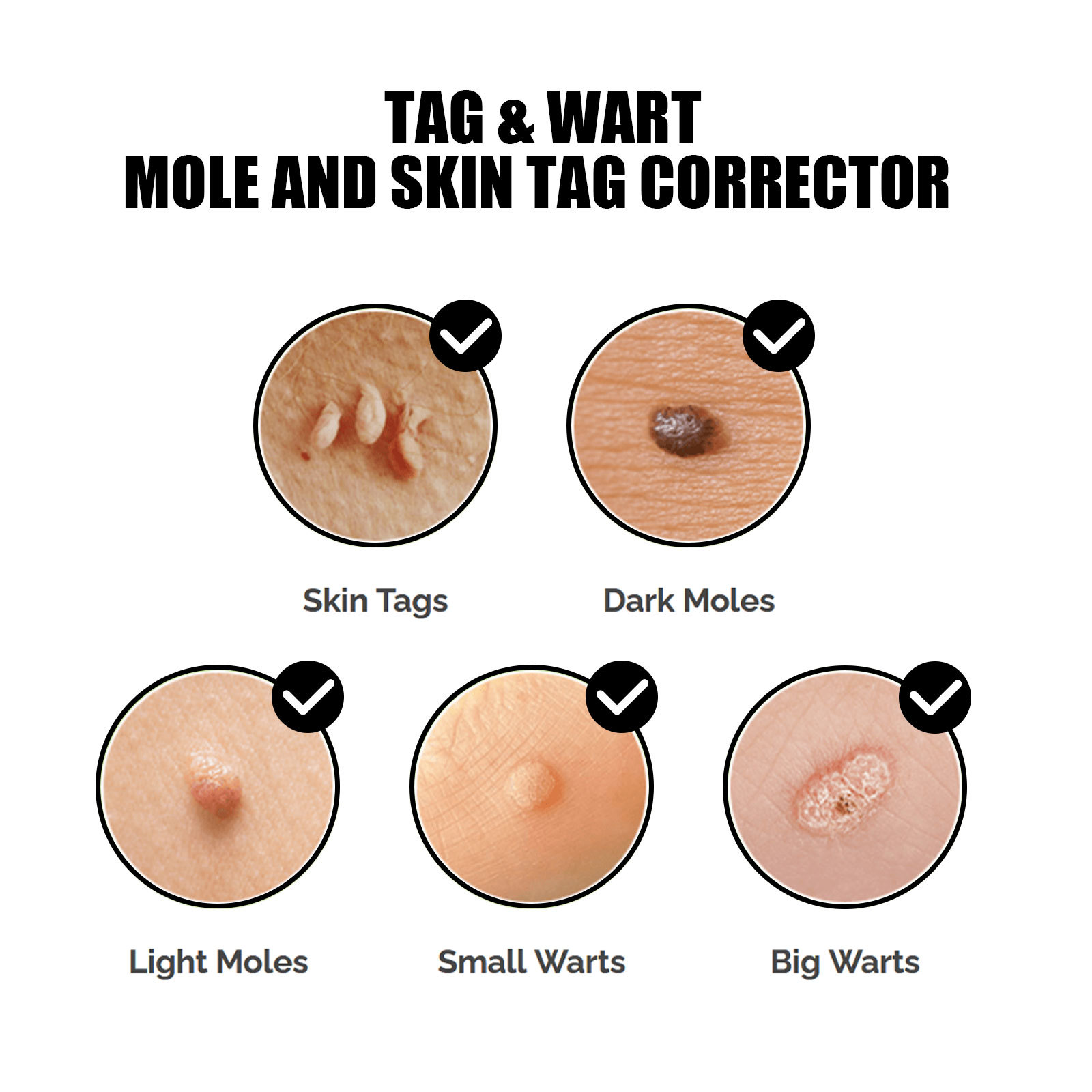 EELHOE repairing spots essence for skin flattening, wart removing and nevus eliminating solution_voghion.com