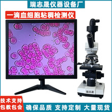 一滴血检测仪血液细胞粘稠头皮眼睫毛螨虫美容院水产养殖精子活力
