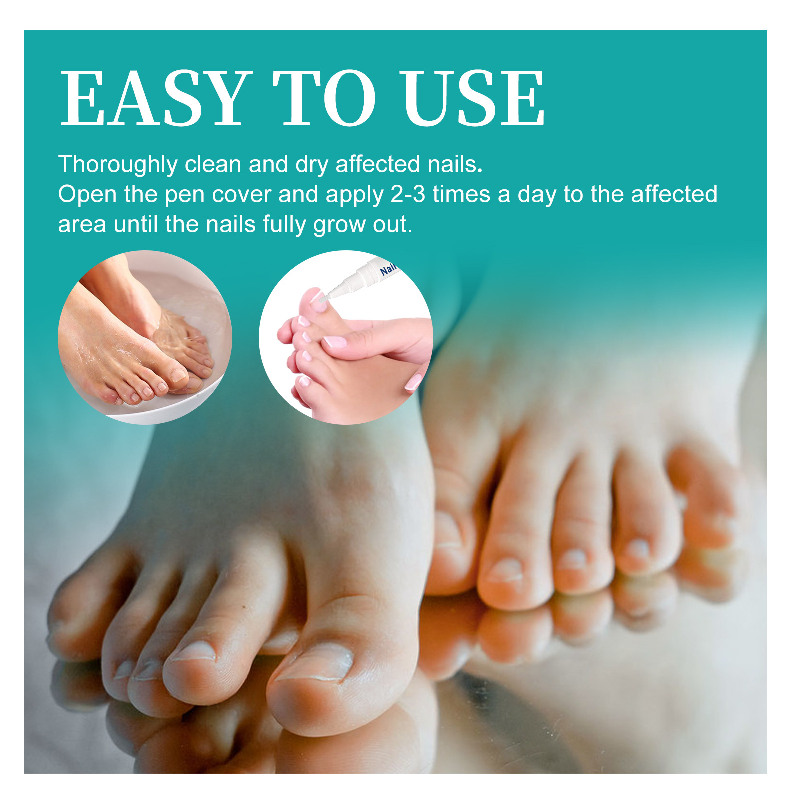 Stylo de réparation South Moon répare les mains et les pieds gris ongles doux brillants épaississement de la Surface des ongles soin hydratant_voghion.com