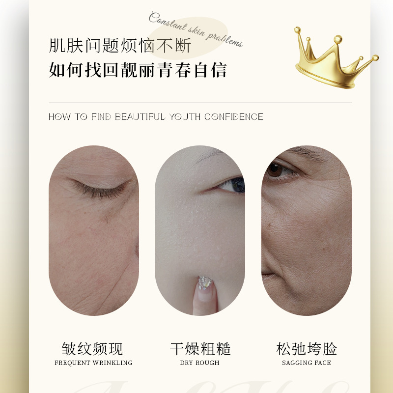 DNA白细胞奇迹冻龄面霜补水保湿淡纹紧致抗皱胶原霜润肤面霜代发|undefined