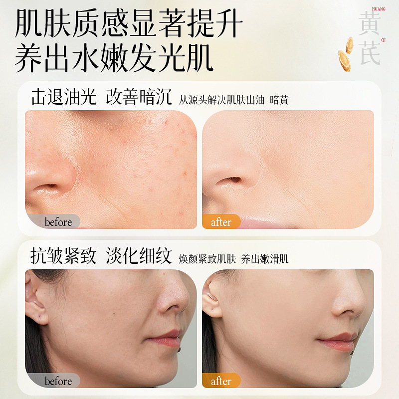 研春堂オウギはしわに強い精華乳を明るくして、小紋を薄めて水を補って保湿します。|undefined