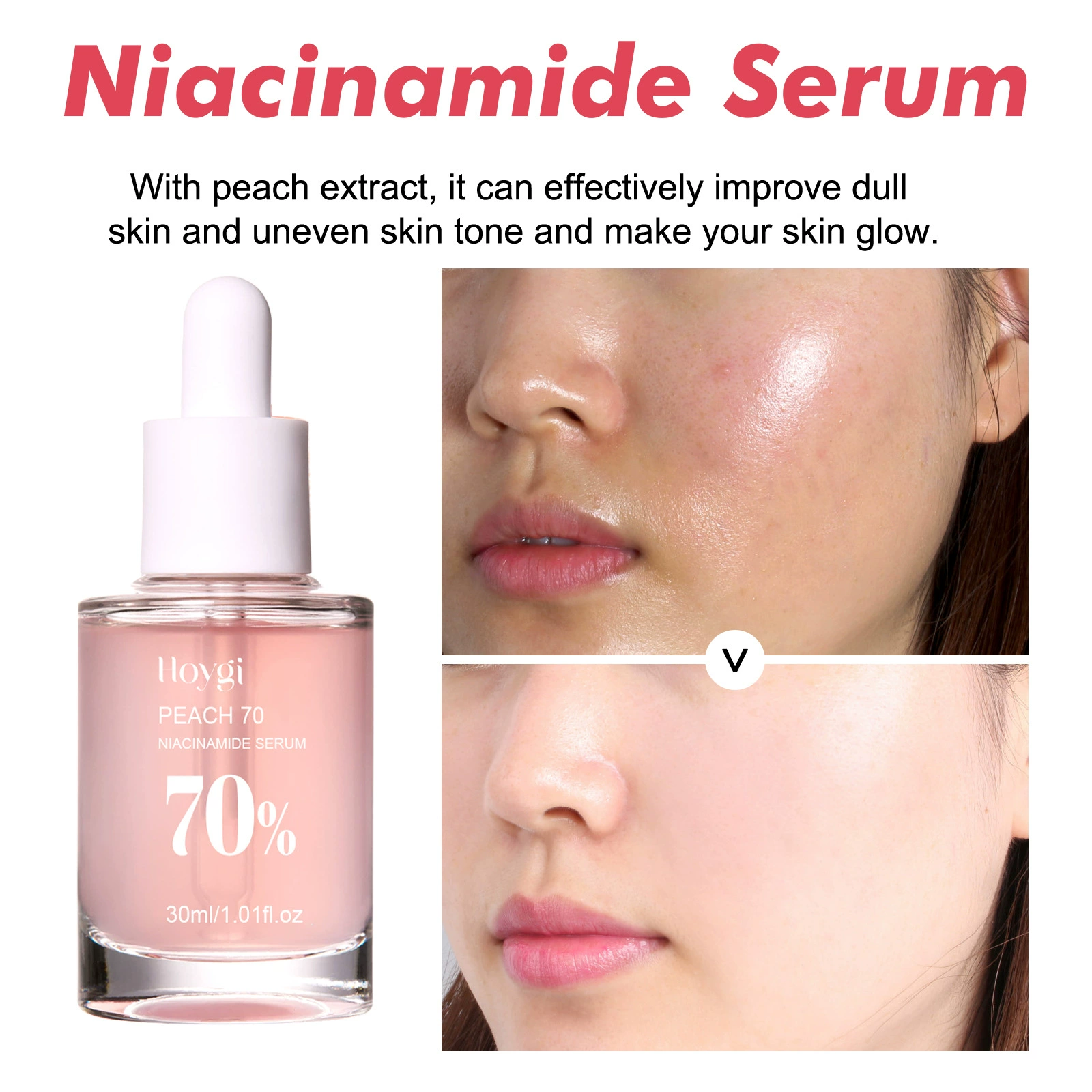 Серум (Hoygi Peach 70) ниацинамид 70%, осветляющий и увлажняющий, уменьшение пор, 30 мл
