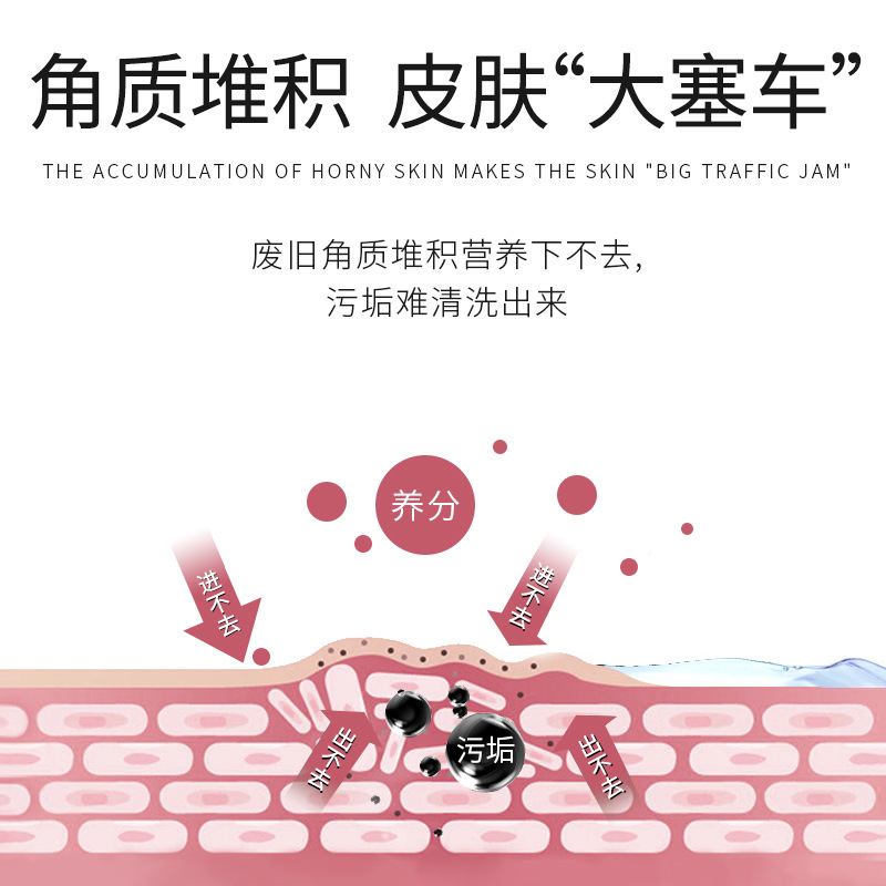 果酸去角質啫喱面部清潔毛孔身體去死皮祛黑頭去角質凝膠批發