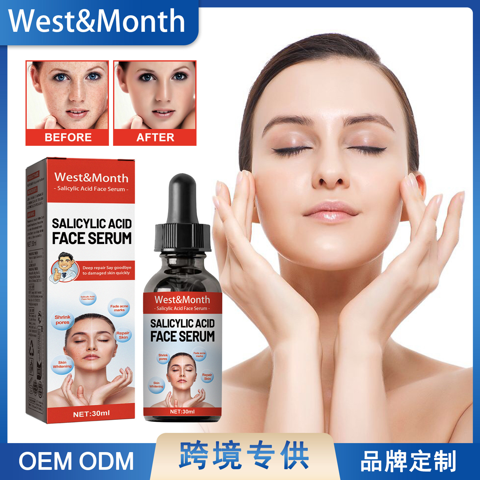 West & Month Salicylic Acid Facial Essence Fades Spots, Pockmarks, Blackheads, Improves Dull and Moisturizes Face