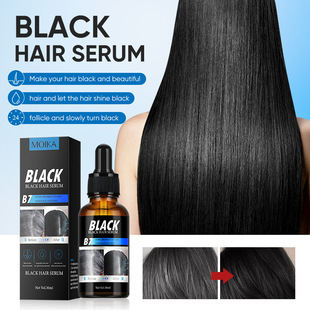 ���Q����Ӣ�İ�ڰl���AҺ�TĨ�^�l�װl�����o�l���;��A�ؿ羳