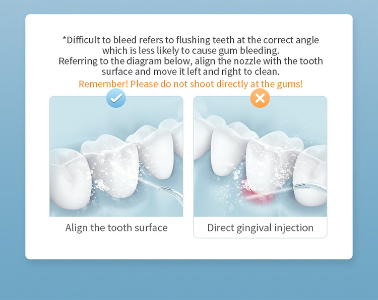 Draagbare elektrische monddouche voor gebitsreiniging_voghion.com