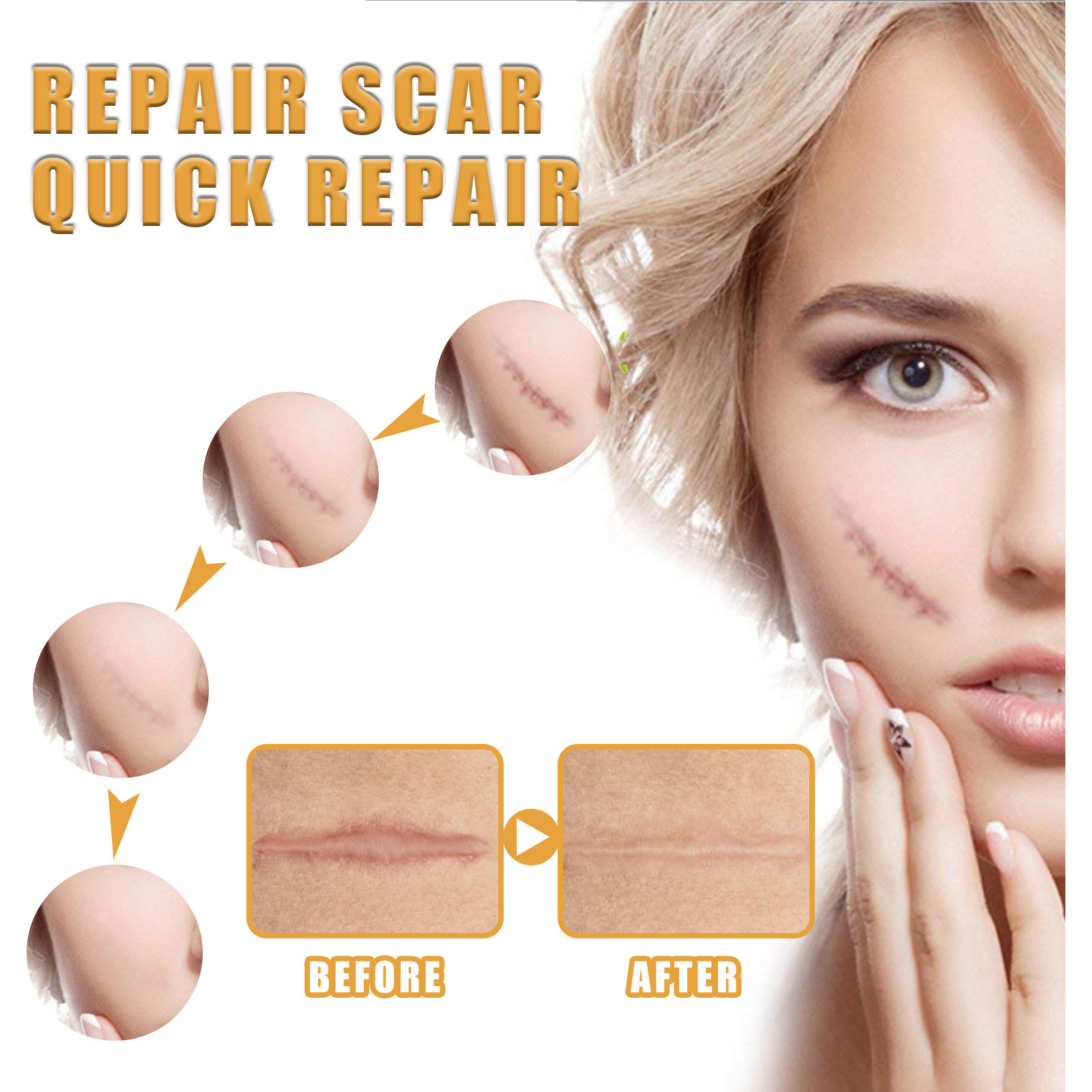 EELHOE Scar Cream Fading Hud Trauma Reparation Forbrænding Forbrænding Fading Cream Kirurgisk reparation Scar Scar Cream_voghion.com
