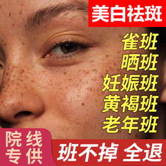 美容院のシミ取りクリームは効果的にソバカスに行きます。