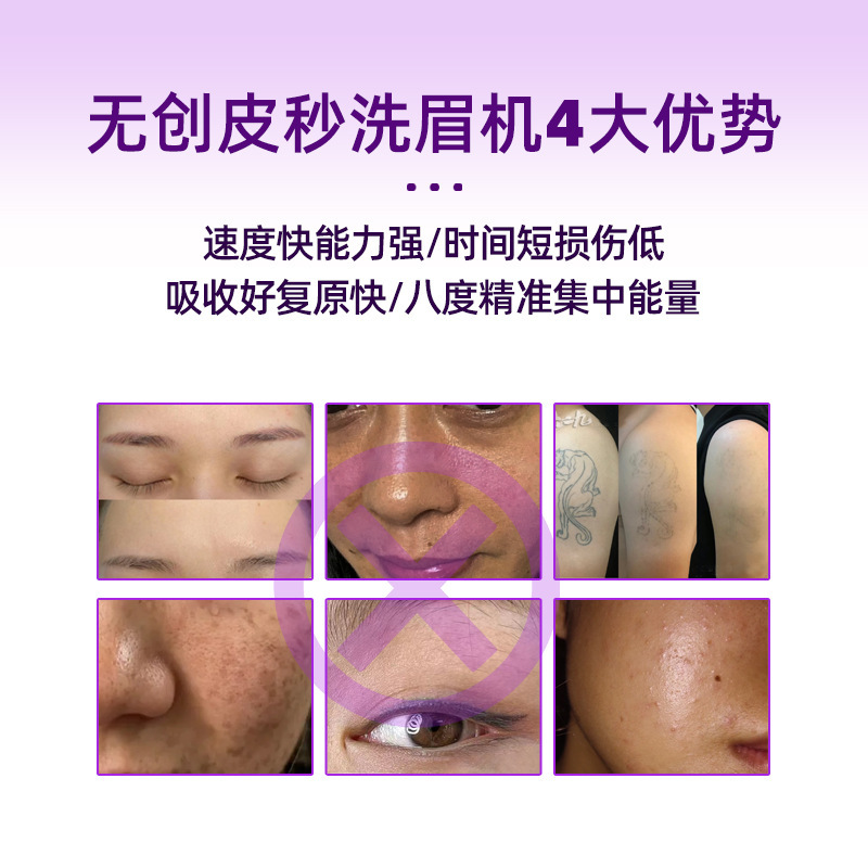 黒金剛携帯式スーツケース810無創眉毛洗浄機氷点下肌器タトゥー除去美容院用|undefined