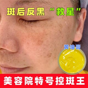 ��ɫ˪����˪��ֹ���ڟ��˪�A����ɫ�ػ���������ߴ��x˪�S�͸�