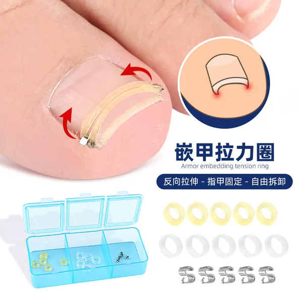 Toe inlaid nail ring stretch rebound nail groove nail roll physical reverse stretch walkable washable reusable