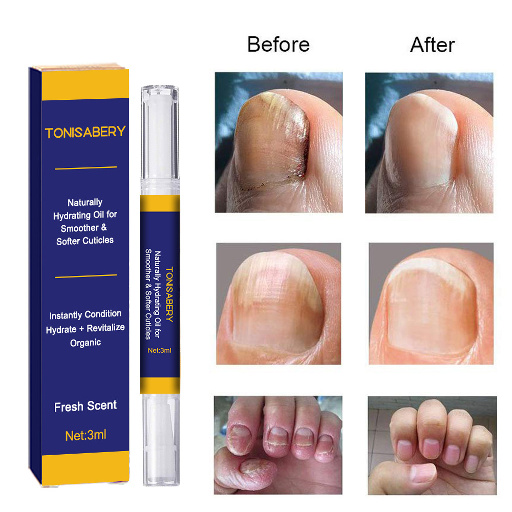 Nagelgro Kräidernagelléisung, One-Strike Hell Reparatur Stéck/Box biologesch Fleegeléisung iwwer_voghion.com