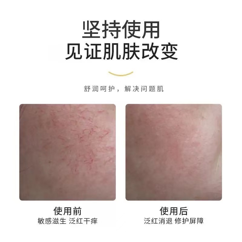 胺肌修护霜舒缓补水保湿霜修护屏障敏感肌紧致美白滋润美容院专供|undefined