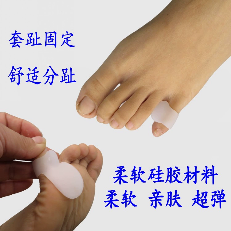 Детские разделители пальцев ног изогнутые и перекрывающиеся корректоры пальцев ног