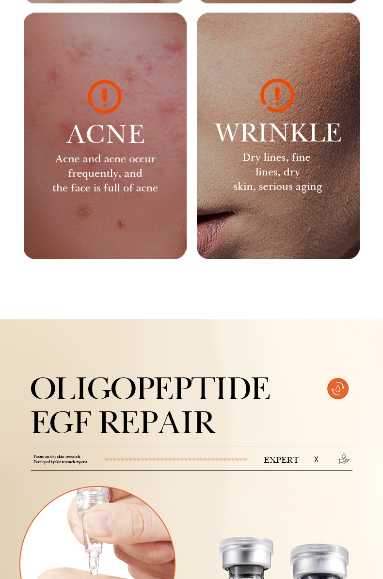 Repair BIOAOUA Oligopeptide Lyophilisiertes Puderset für empfindliche Haut, feuchtigkeitsspendend und glatt, Originalflüssigkeit_voghion.com