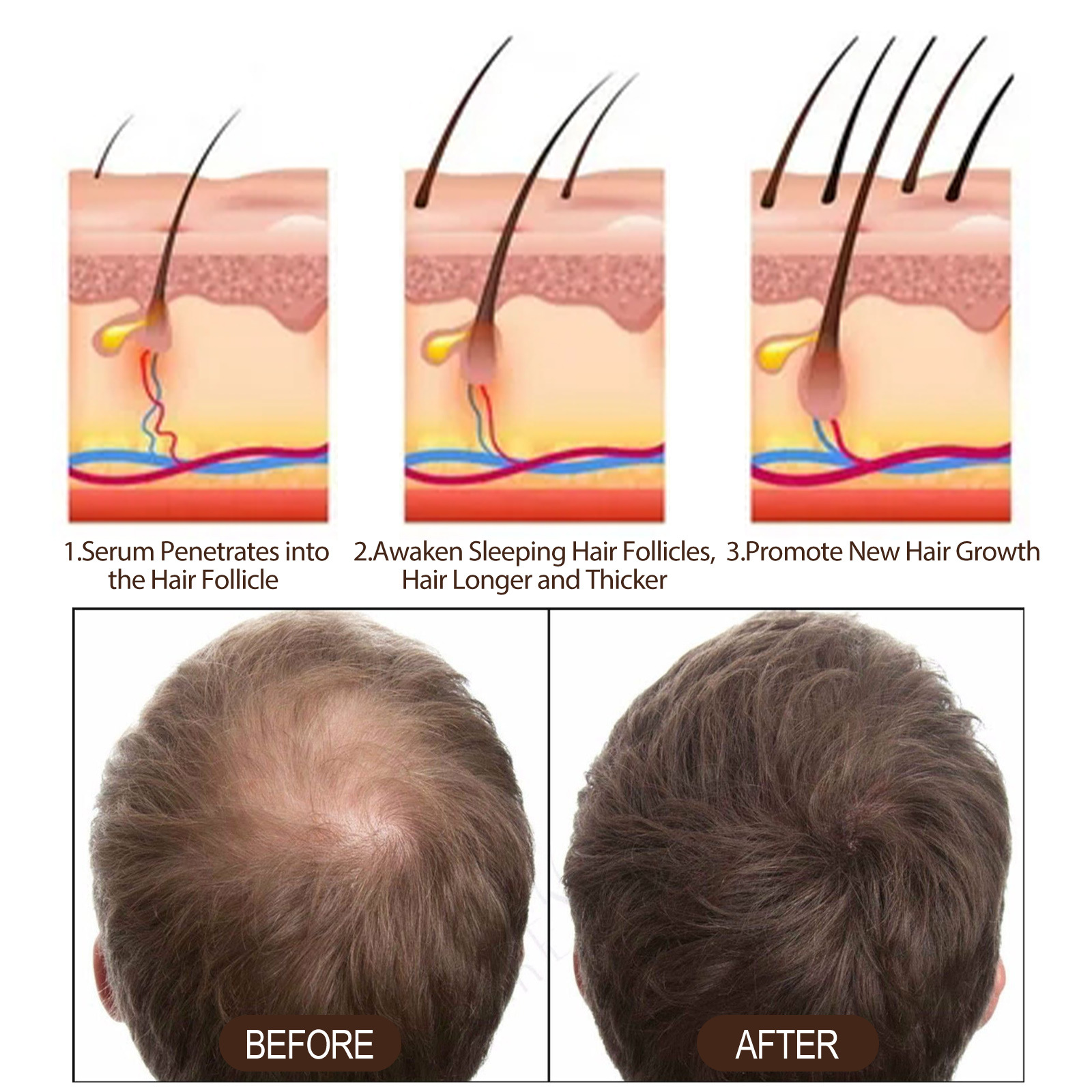 Essenza per capelli resistente, compatta, idratante, riparatrice dell'attaccatura delle radici, densa_voghion.com