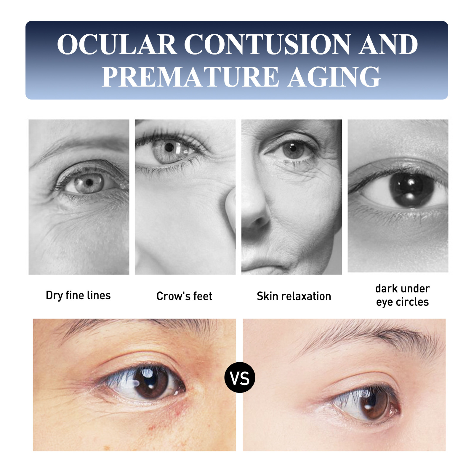 Rimpel Jaysuing Instant Resisting Eye Lifts, Sparren, Vervaagt Hoeken, Fijne Lijntjes, Reparaties en Hydrateert Anti A_voghion.com