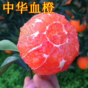 ���A�t��Ѫ���� �t��Ě�ȹ����� ��ȱ����۳��Ә� ����Y��