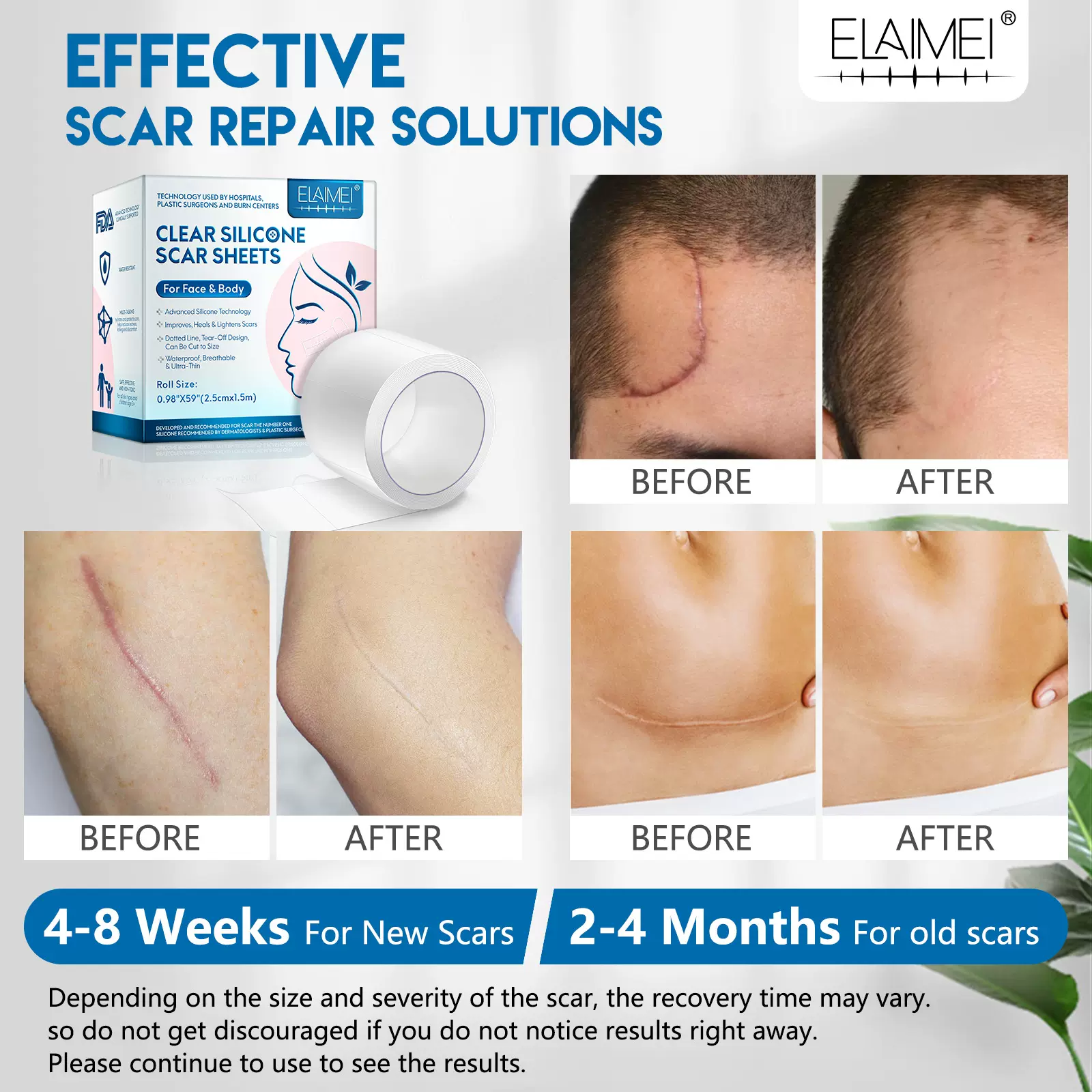 外贸ELAIMEI硅凝胶隐形面部淡疤卷手术伤疤修护贴淡化烧烫疤痕贴