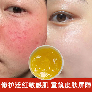 ��Ч�ޏ͸�ȥ�tѪ�z����Ę�ޏ����м��f�ܸ�������|���˼t�ޏ�˪