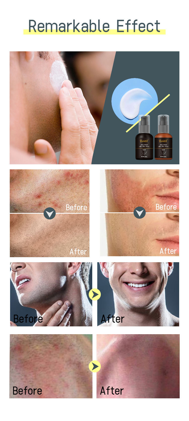 平台-详情BUNEE须后乳60ml棕黑瓶2022.11.14