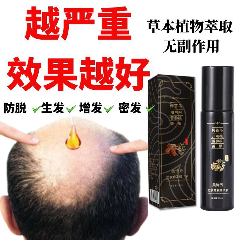 Meishixiu 育毛血清、脱毛防止育毛血清、濃密な髪を増やす、Polygonum multiflorum 固定育毛血清、毛包修復血清|undefined