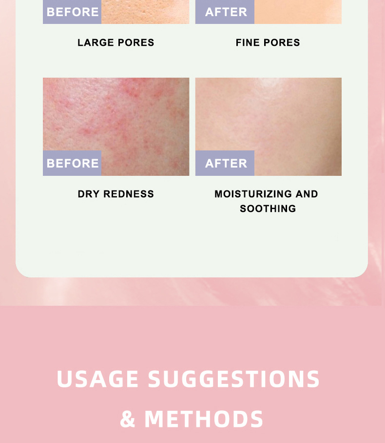 绿紫粉黑四合一的详情