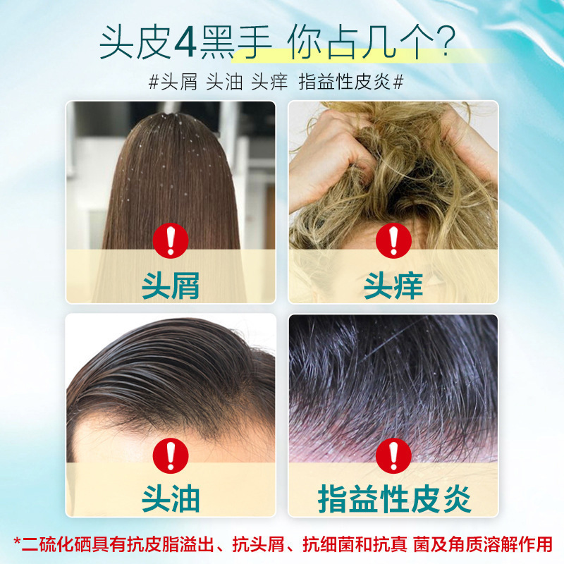 芙诗婷二硫化硒洗发水控油去屑止痒柔顺洗头膏洗发水露厂家批发|undefined
