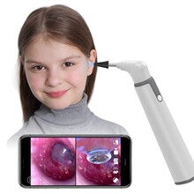 HD720P 6LED WIFI ���R 3.9mm smart Otoscope ���� �Զ���