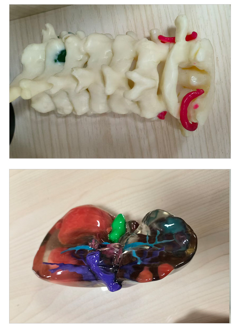 3D Printed Medical Prototype Model, 3D Printed Resin Prototype Model, Rapid Prototyping, Custom Processing from Provided Drawings