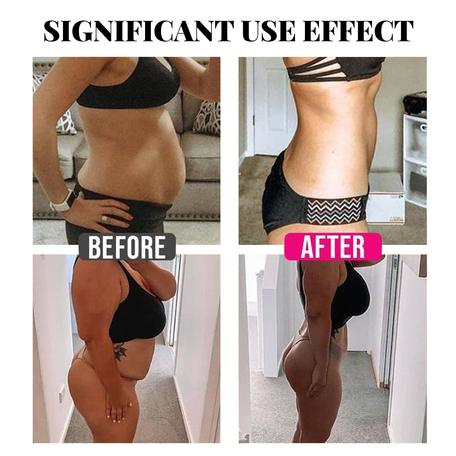 EELHOE Body Slimming & Vacker för att ta bort mage och lårmuskler uppstramande Skin Shaping spray_voghion.com