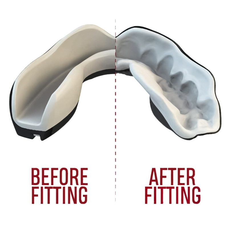 Boxeo brackets, brackets deportivos EVA de grado alimenticio, brackets deportivos de lucha libre, Sanda, entrenamiento de taekwondo, brackets deportivos