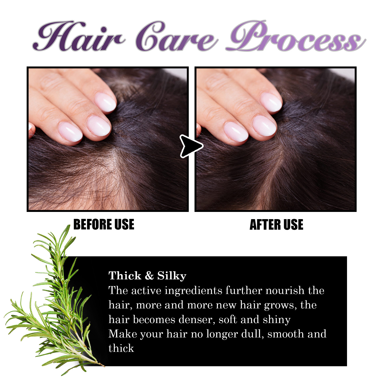 EELHOE Cipolla Rosmarino Spray per spessore dei capelli Idrata in profondità il cuoio capelluto liscio Spray per la cura dei capelli per lo spessore dei capelli_voghion.com