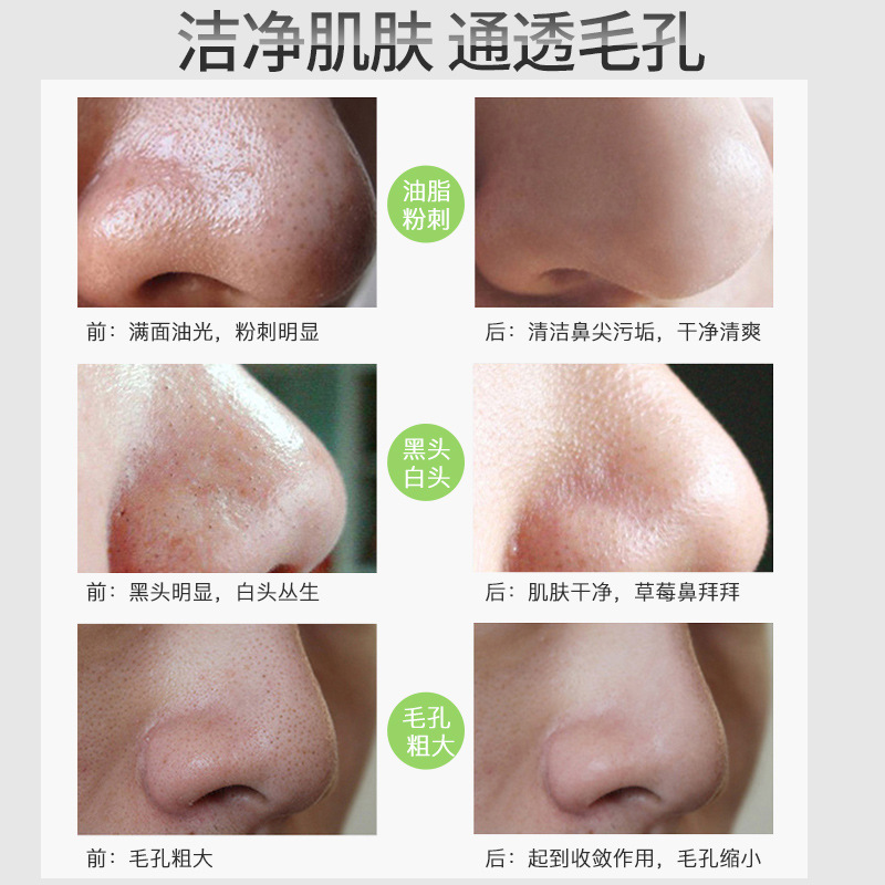 Imagen belleza carbón de bambú eliminación de espinillas limpieza máscara nasal crema limpieza profunda espinillas acné lagrimeo máscara nasal al por mayor image 6