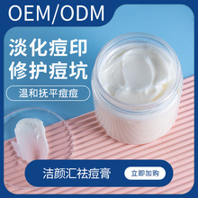 祛痘膏1000g院装 小白瓶祛痘膏  oem化妆品设计定制加工一条龙