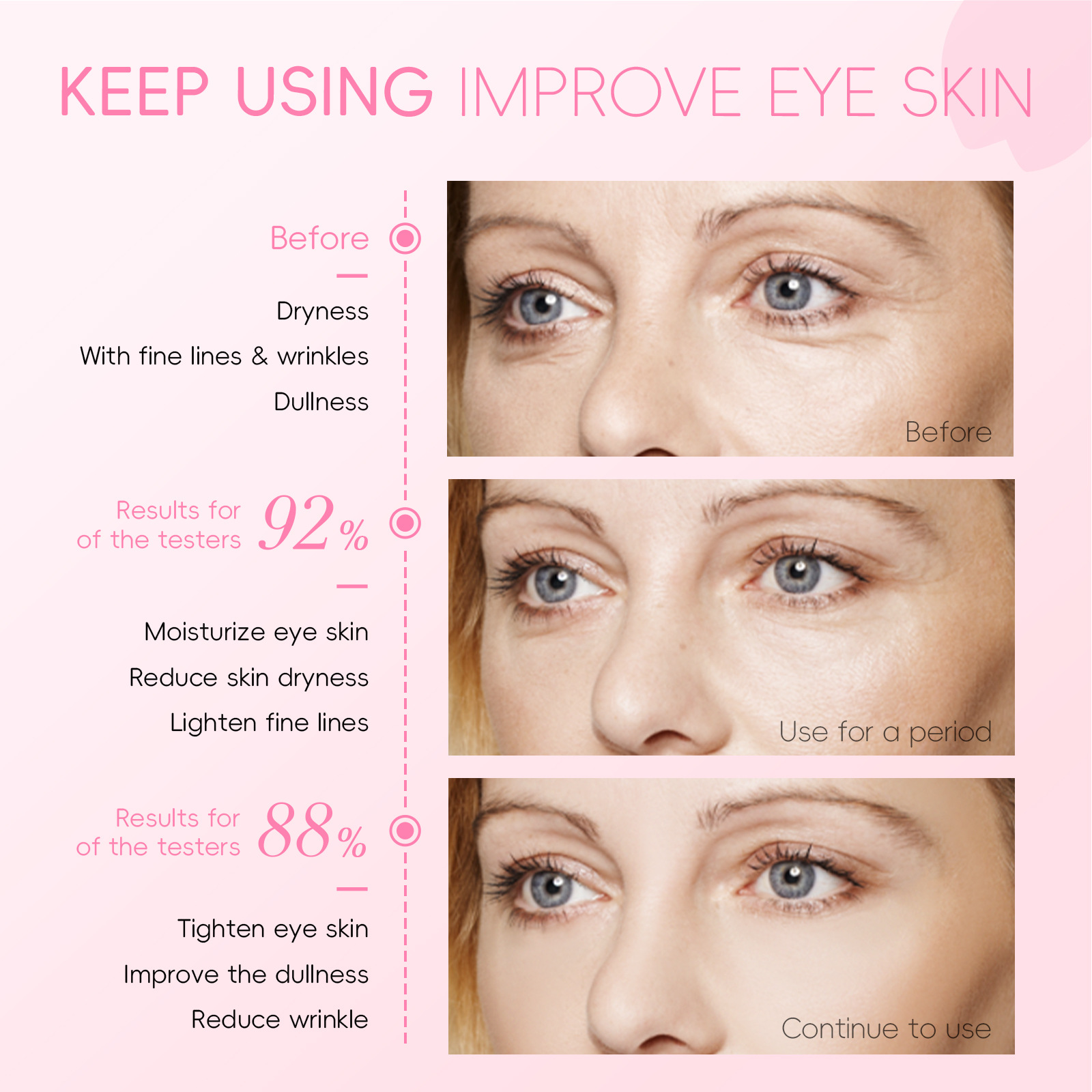 Cross-border Fenyi Cherry Blossom Eye Serum 15ml Hydrates, moisturizes and cares for the skin around the eyes. Manufacturer's supply undefined