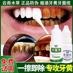 Plaque net teeth whitening one wipe descaling quick wash effect yellow black calculus tea smoke stain dental plaque gram magic star device